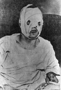 File:Bandaged Billy Conn.jpg
