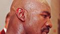 Biten ear of Holyfield.jpg