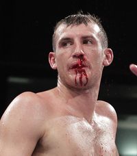 File:Derry Mathews bust nose against Rees first fight.jpg