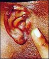 Thumbnail for version as of 02:03, 3 November 2005