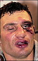 Klitschko After Lewis.jpg