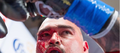 Thumbnail for version as of 03:17, 12 May 2015