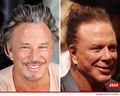Mickey-Rourke-Plastic-Surgery2010.jpg