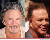 File:Mickey-Rourke-Plastic-Surgery2010.jpg