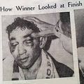 Pep after the second Saddler fight.jpg