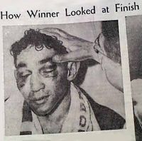 File:Pep after the second Saddler fight.jpg